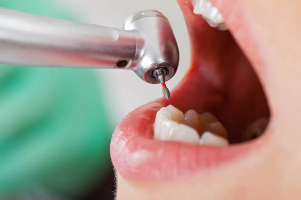 Best Dentist for Dental Trauma  in Friend, NE